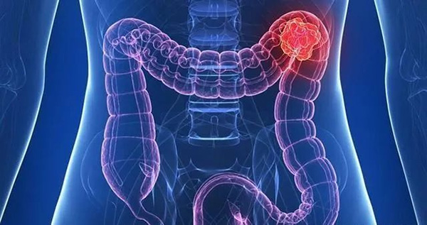 图片18.jpg 图片18.jpg