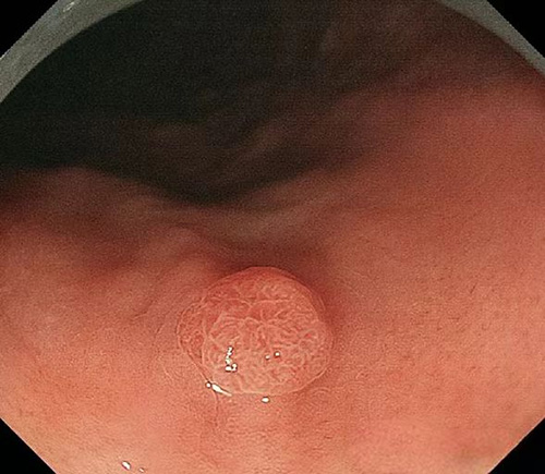 图片24.jpg 图片24.jpg